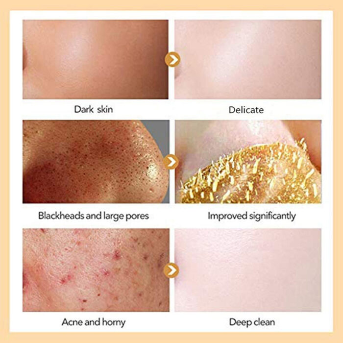 Enhance skin collagen content, improve sagging, and restore youthful radiance.