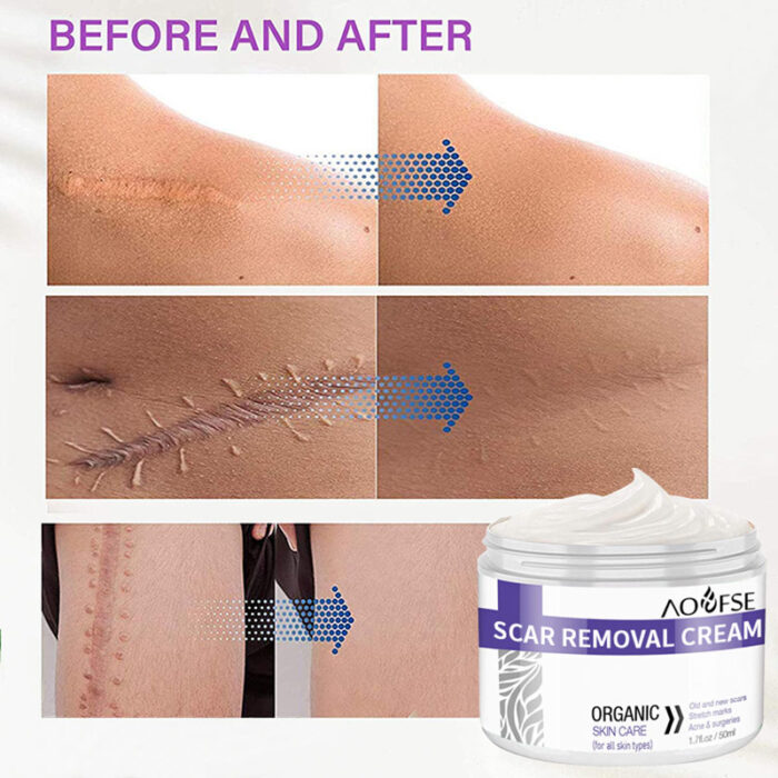 Prevent new wrinkles and fade old silver-white wrinkles