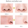 Turmeric Herbal Deep Cleansing Detox Stick Mask,Natural anti-inflammatory detoxification, inhibits acne formation, lightens spots, and brightens dull skin tone.