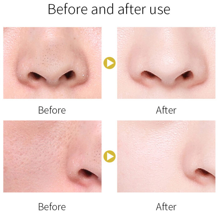 Turmeric Herbal Deep Cleansing Detox Stick Mask,Natural anti-inflammatory detoxification, inhibits acne formation, lightens spots, and brightens dull skin tone.