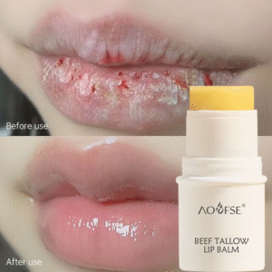 Dry Cracked Repair Lip Balm Stick – Grass-Fed Tallow Lip Butter
